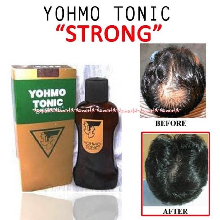 

Yohmo Tonic Hair Tonic Penyubur Rambut 200ml Tonic Penumbuh Rambut