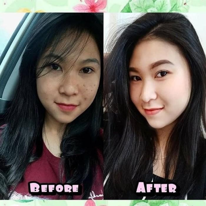 Vitaline Softgels / Vitagel / Vitaline Softgels Pemutih Badan