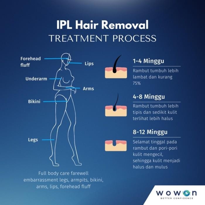 Wowon 4In1 Ipl Hair Removal - Alat Penghilang Rambut Secara Permanen