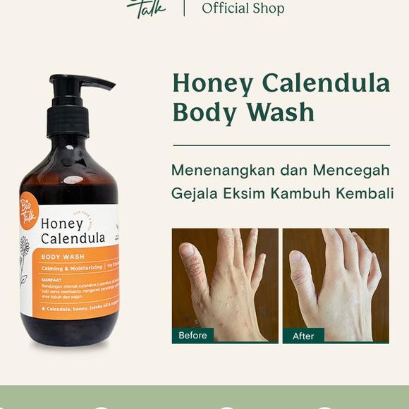 

New Launch Biotal Honey Calendula Body Wah 300 Ml No Lle Abun Mandi Cair Natural Melembaban Dan Menenangan Ulit Eim Pai Enitif Alergi Ering Buan Paet Et Ecan