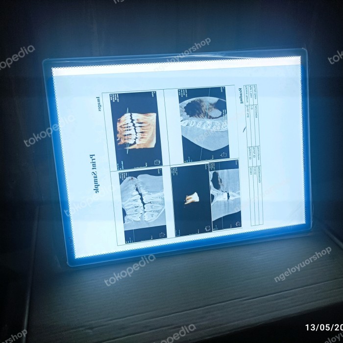 Terlaris X-Ray Film Viewer Portable, Film Viewer X-Ray Ipad Board A4