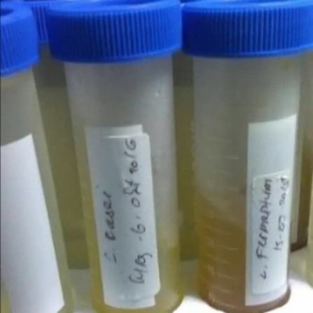 Kultur Lactobacillus rhamnosus : Bakteri Probiotik.