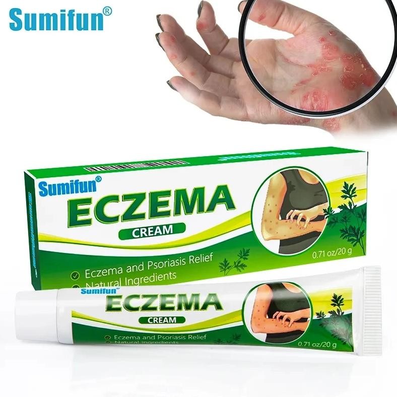 20g sumifun eczema cream dermatitis psoriasis antibacterial skin care ointment treat rash urticaria 