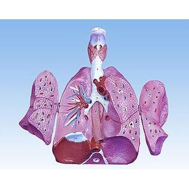 

Model Paru-paru Manusia / Alat Peraga Biologi Paru-Paru Manusia