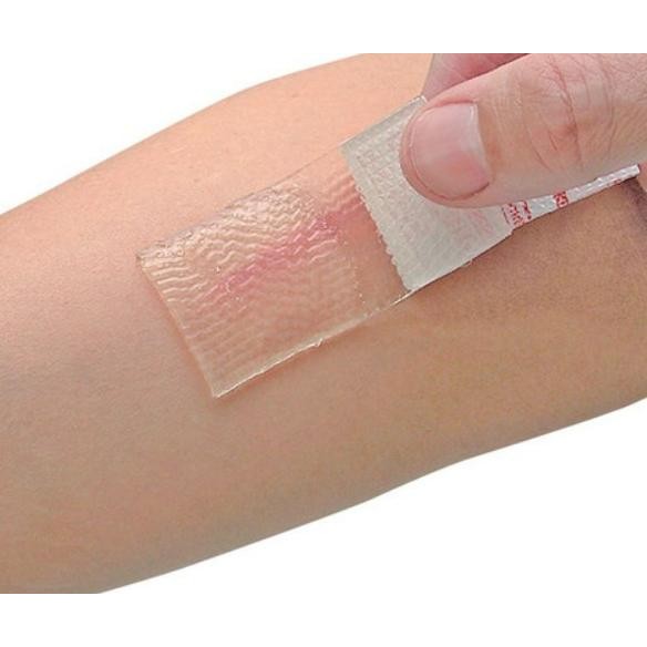 Cica-Care Silicone Gel untuk Keloid