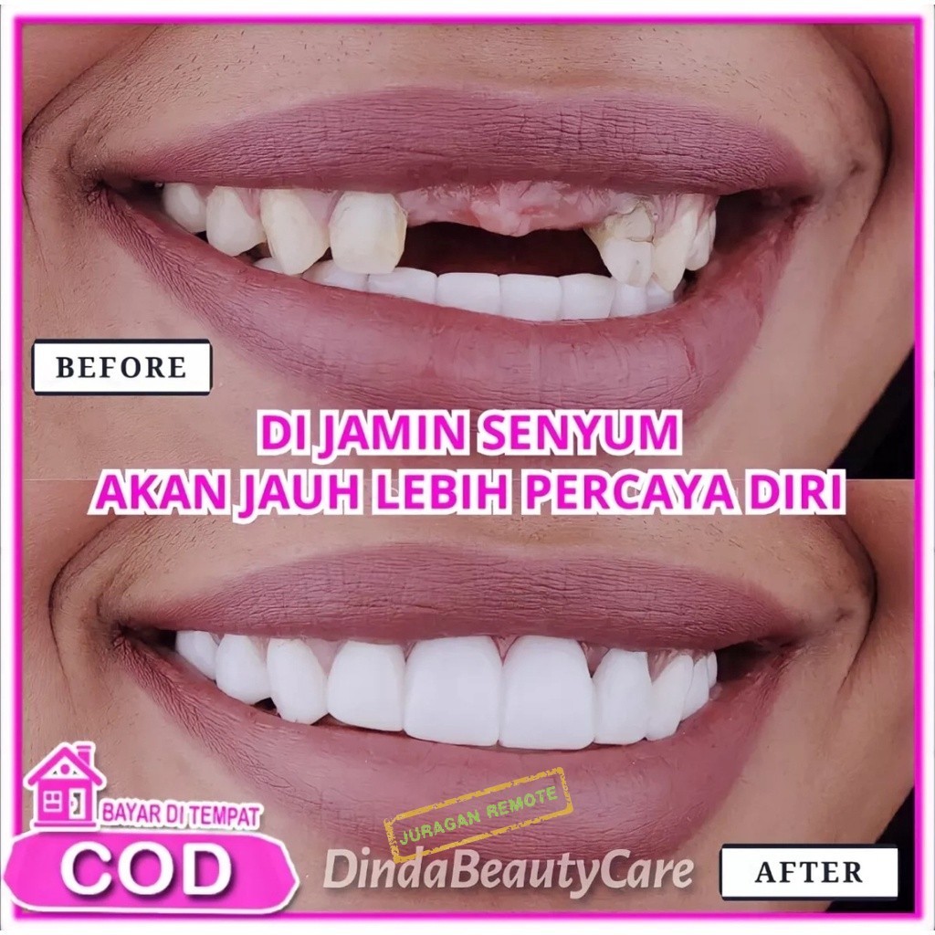 KUAT DI PAKAI MAKAN 1 Set Gigi Palsu Instan Atas Bawah Penutup Ompong Lepas Pasang Snap on Smile Ori