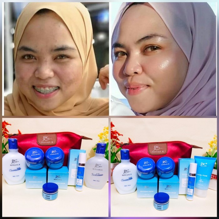 Paket Flek Hitam Aman Untuk Bumil Busui Skincare Dr Supijati