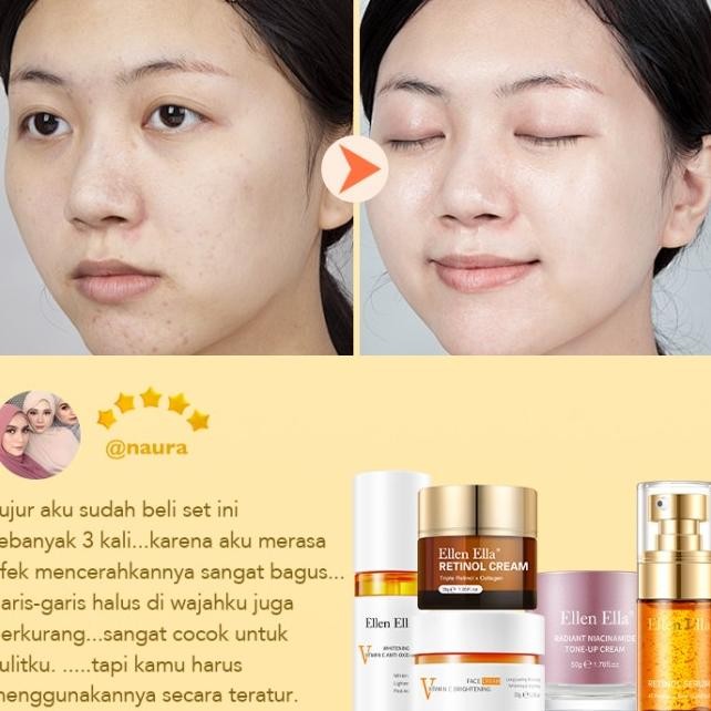 [Bpom]Ellen Ella 5Pcs Glowing Set Dark Spot Paket Wajah Atasi Bintik Flek Hitam Serum Vitan C Cream 