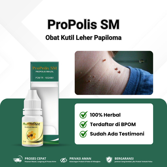 Terbaru Obat Kutil Leher Papiloma, Perontok Papiloma Di Leher Wajah, Propolis