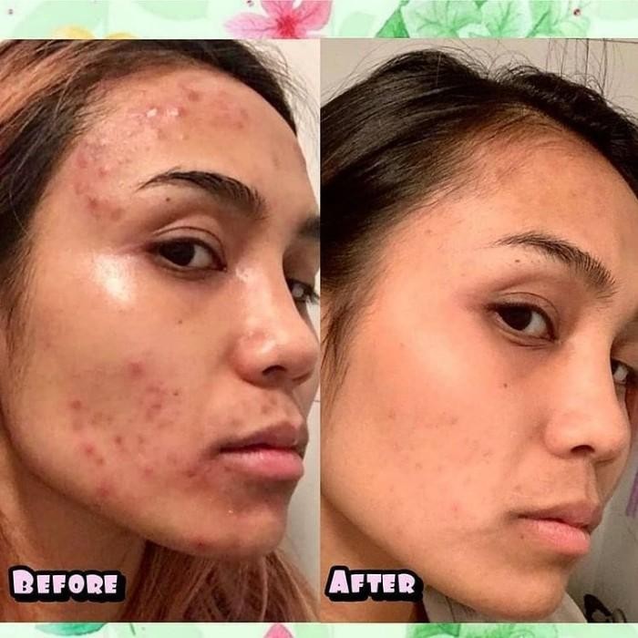 Vitaline Softgels / Vitagel / Vitaline Softgels Pemutih Badan