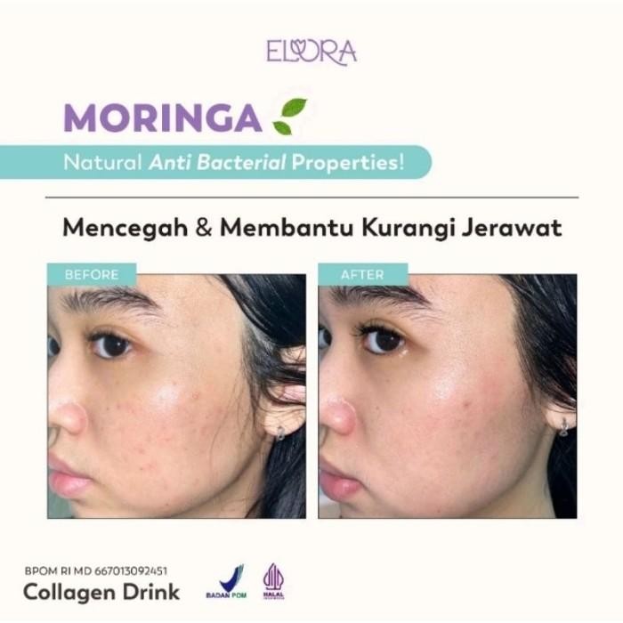 Elora Collagen Drink / Minuman Kolagen Kecantikan Bpom Halal