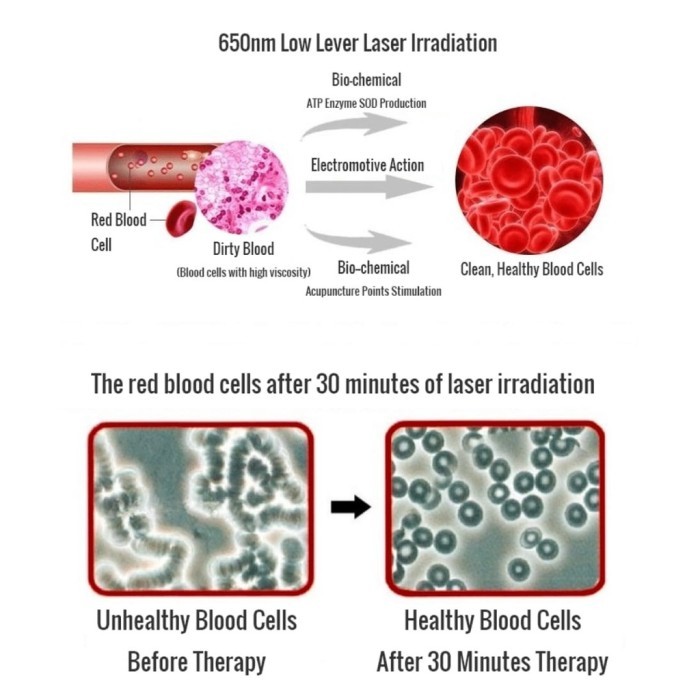 Jam Laser Terapi 12 / 15 Titik Fisioterapi Semikonduktor