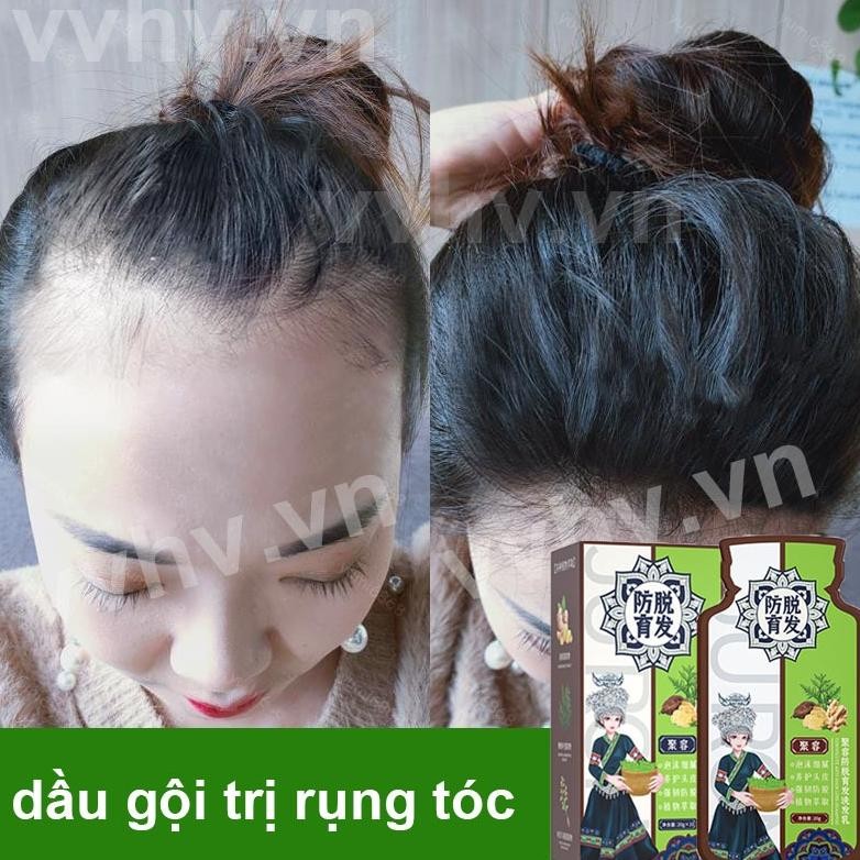 sampo penumbuh rambut cepat Shampo Jahe sampo rambut rontok sampo jahe penumbuh rambut Treatment Ant