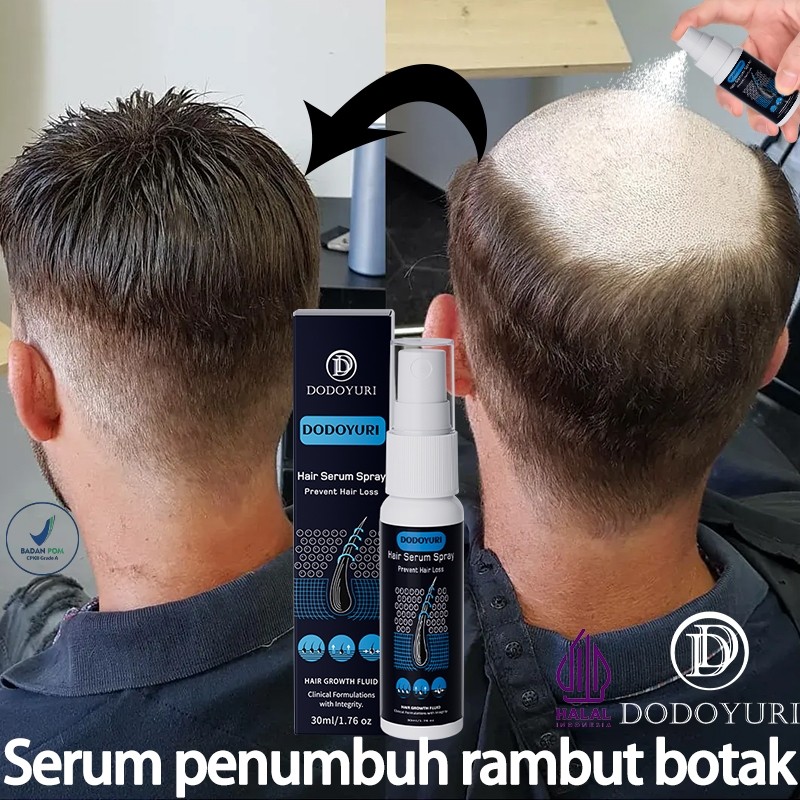 (Bpom)Serum Umbuh Rambut Obat Umbuh Rambut Umbuh Rambut Botak Hair Serum Umbuh Rambut 30Ml Serum