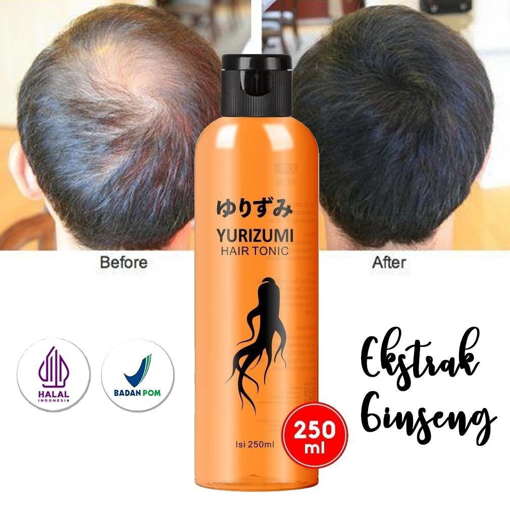 Eqw-68 ( Bpom ) Red Ginseng Korea Hair Tonic Original Penumbuh Rambut Botak Dan Penyubur Rambut - 25