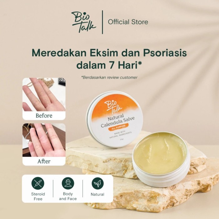 Biotalk Calendula Healing Salve, Pereda Ruam, Balm Luka, Bekas Luka