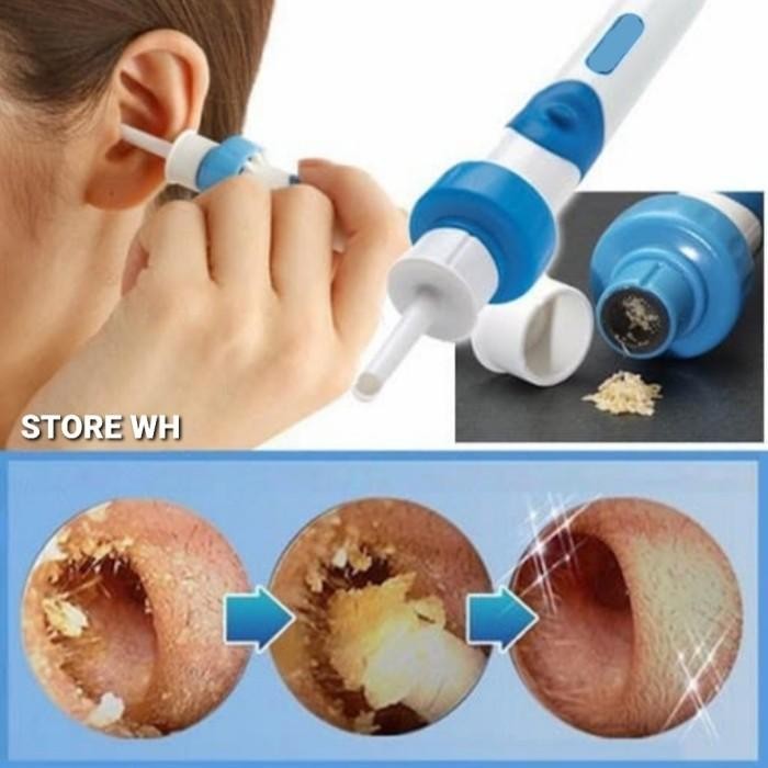 Alat Penyedot Pembersih Kotoran Telinga Dewasa /Anak