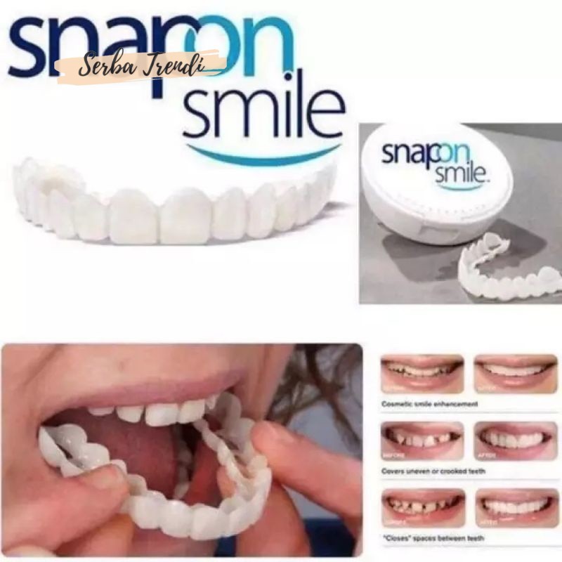 Gigi palsu atas bawah gigi putih