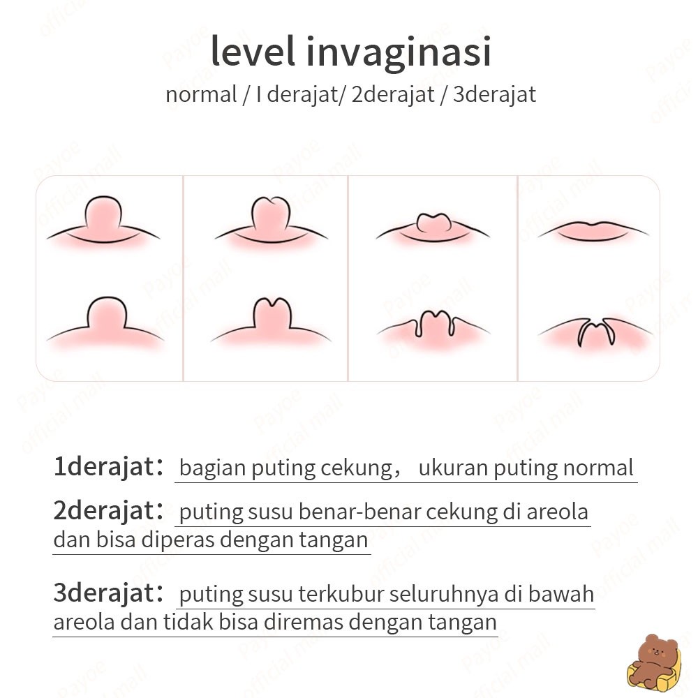 Awet Payoe Nipple Puller Penarik Puting/Penutup Penarik Puting PayudaraSilikon