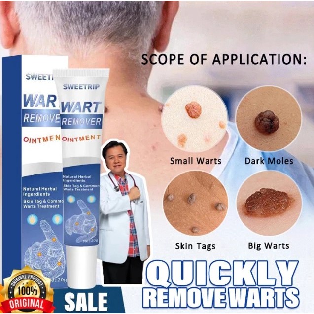 Menghilangkan Kutil Tahi Lalat Penghilang Tahi Lalat Penghilang Kutil Dan Tahi Lalat