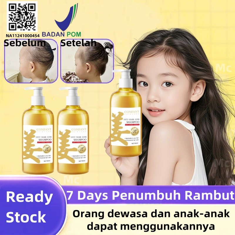 Hampo Umbuh Rambut Cepat Umbuh Rambut Bota Ginger Hampoo Pertumbuhan Rambut Anti Rambut Ronto