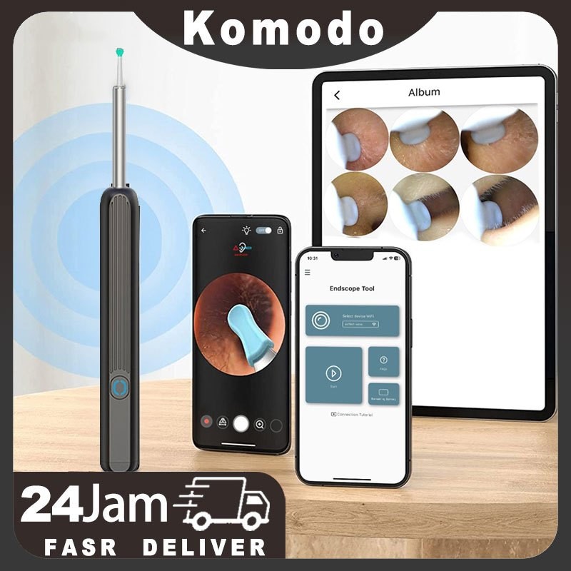 Pembersih Telinga Bayi Korek Kuping Pembersih Kuping Smart Led Kamera Wifi Hp Korek Kuping Bayi