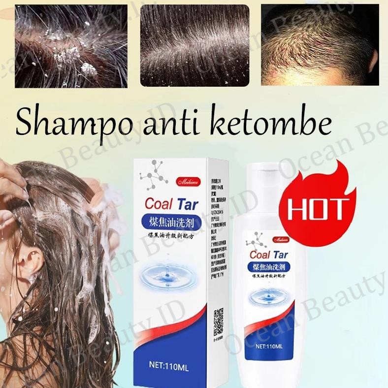hjk Shampoo kutu rambut Sampo kutu Penghilang kutu Shampo kutu rambut anak Telur kutu rambut Sampo k