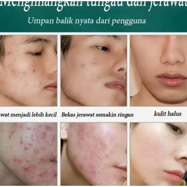 Nicor Pembersih Wajah Pria Sabun Cuci Muka Ghilang Jerawat