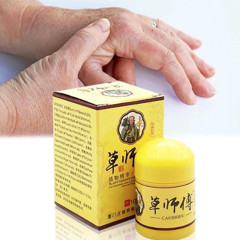 zb caoshifu skin psoriasis cream dermatitis eczematoid ointment treatment psoriasis urticaria acne c