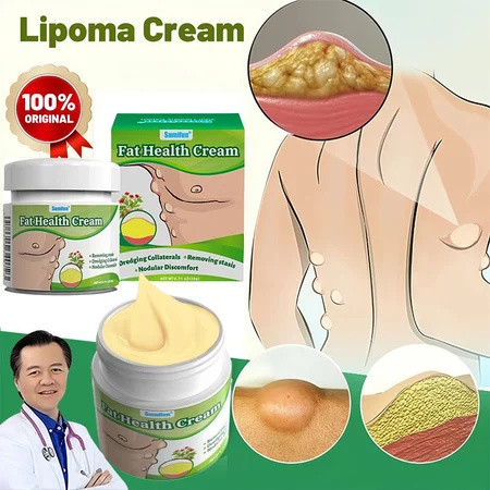 lipoma cream obat benjolan obat lipoma salep benjolan 20g obat benjolan di leher salep benjolan lipo