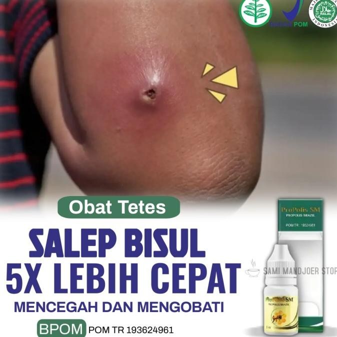 TERLARIS - COD - Obat Bisul, Salep Bisul, Cream Bisul - ProPolis SM 100% ASLI