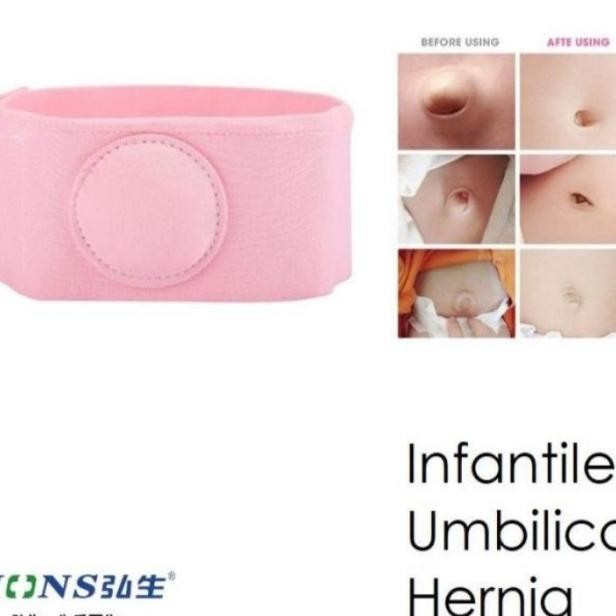 Sabuk Hernia Bayi / Sabuk Pusar Bodong Terapi Anti Udel Bodong Anak Ba