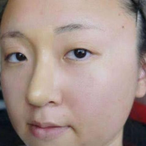 Hidung Korea. Hidung Mancung