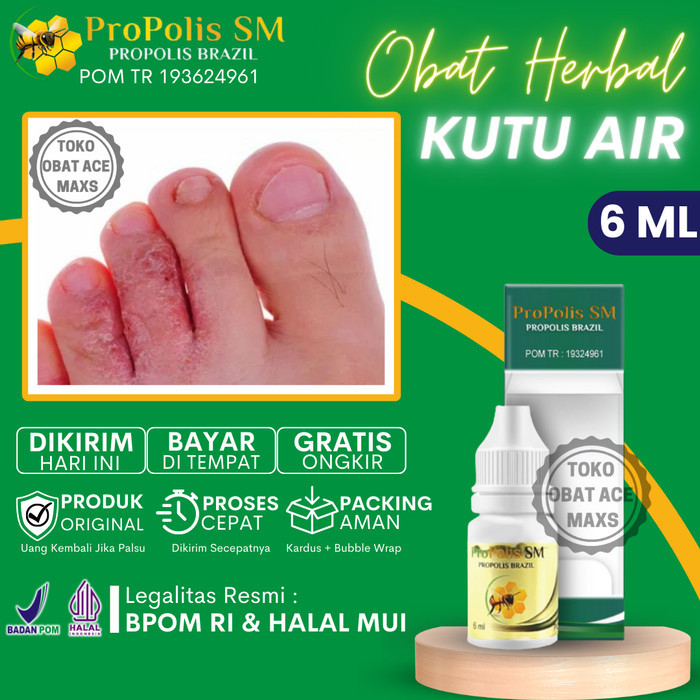 Terbaru Salep Obat Oles Kutu Air & Gatal Sela-Sela Jari Kaki Karena Jamur