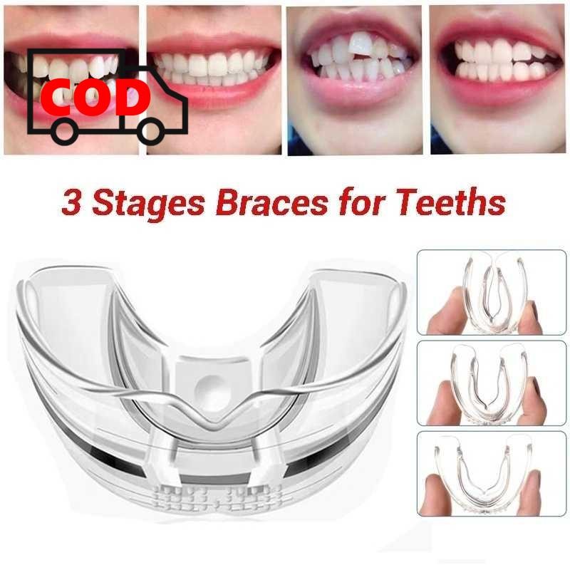 Perapih Gigi Aligner Transparan Bening Dewasa Perata Tanpa Behel Clear Teeth Braces Stage 3