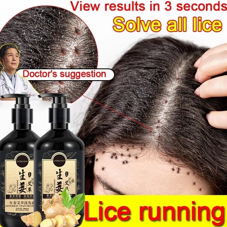 Sampo Anti Ketombe Sampo Ketombe Shampo Kutu Rambut 300ml Ginger Shampoo Herbal Penumbuh Rambut Sham