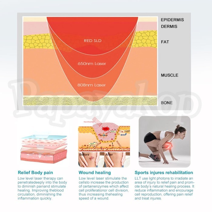 36 Laser Terapi Nyeri Sendi, Syaraf & Otot - Laser Pain Box Relief Dr