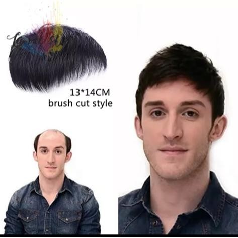 WIG BOTAK WIG PENUTUP KEPALA BOTAK RAMBUT TIPIS