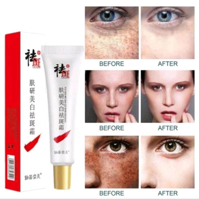CREAM XX103 PENGHILANG FLEK HITAM &BEKAS JERAWAT DI WAJAH SALEP FU YAN MEI BAI ... Dominator Shop