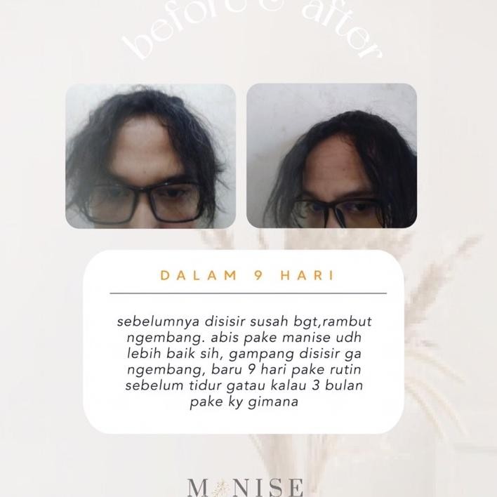 Manise Hair Oil Dewasa Baby Nyak Rambut Keri Anti Rontok Botak Gondrong