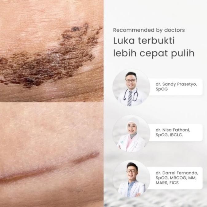 MAMAWAY Nano Bamboo Korset Pelangsing Pasca Melahirkan