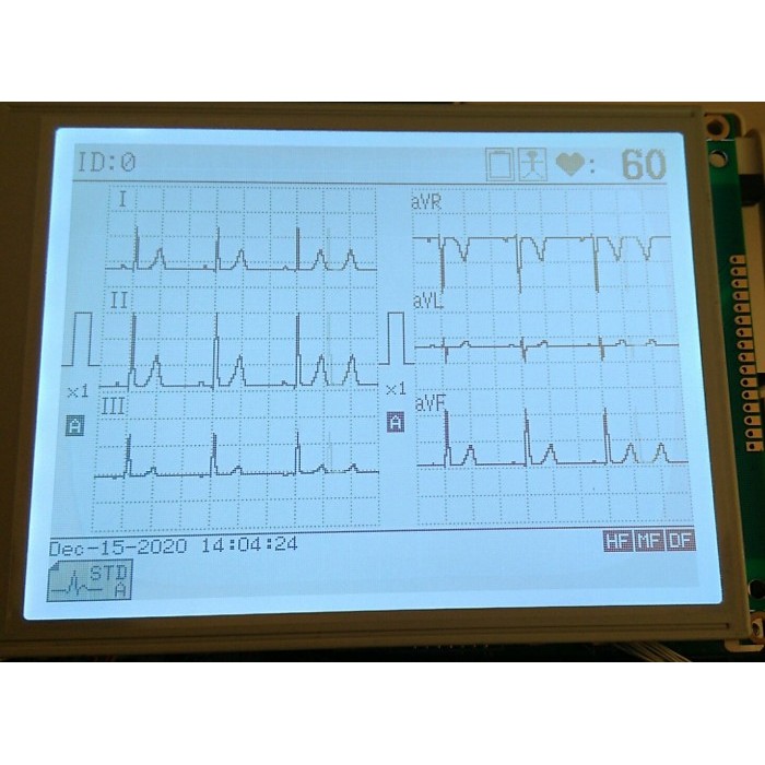LCD UNTUK EKG FUKUDA DENSHI