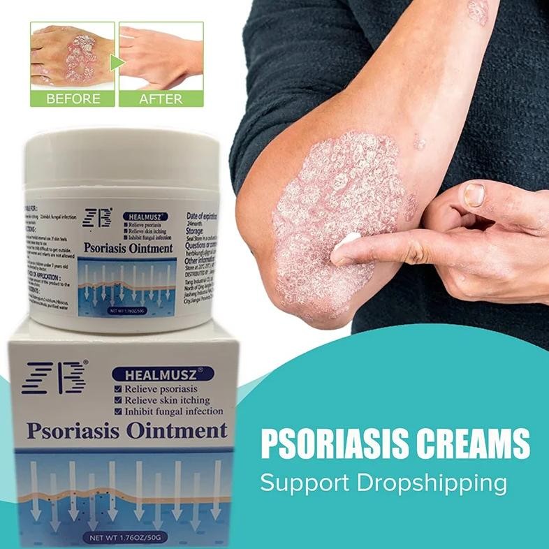 50g dermatiti cream psoriasis eczema antibacterial treat ointment alergy skin urticaria antipruritic