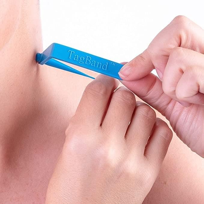Skintag Wart Remover Tools Penghilang Kutil Papiloma Ampuh Original
