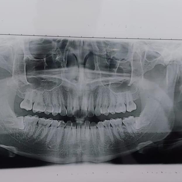 

TERLARIS - kertas YC Paper