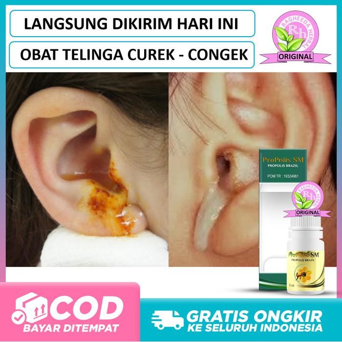 Obat Telinga Congek, Curek, Berdenging, Bernanah, Berair Kuning Bau