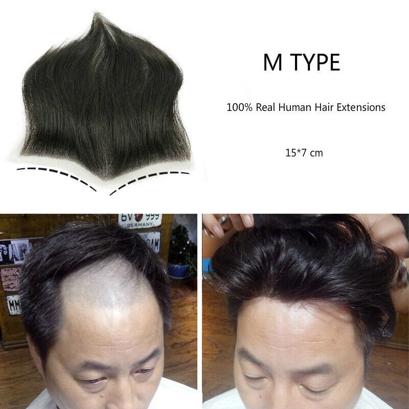 Wig Rambut Palsu Poli Pengganti Rambut Manusia Asli Garis Rambut Dahi Rambut Palsu Pria + |BF7E5085|