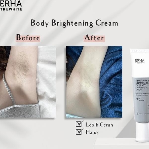 Erha Truwhite Body Ghtening Cream Rim Pemutih Lipatan Dan Etia
