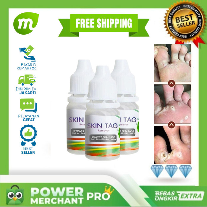 MURAH Obat Mata Ikan di Telapak Kaki Original - Obat Mata Ikan Cair Ampuh