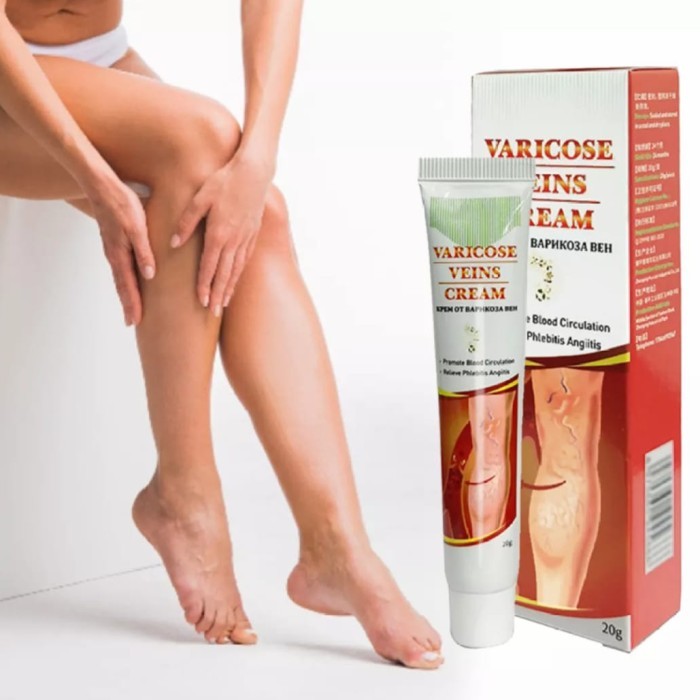 Cream varises/spider veins